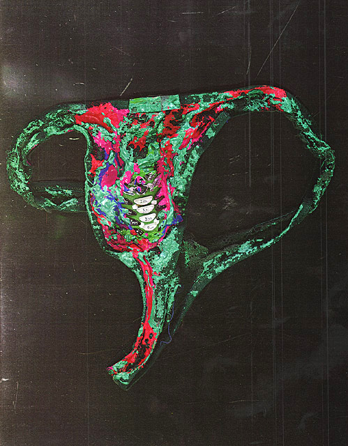 I Won't Extinguish Myself...